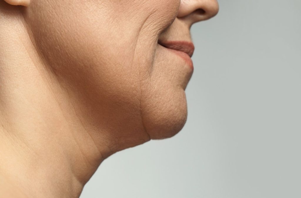 skin laxity featured image