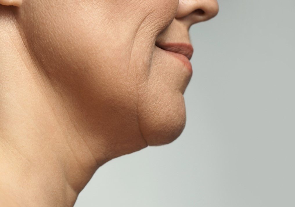 skin laxity featured image